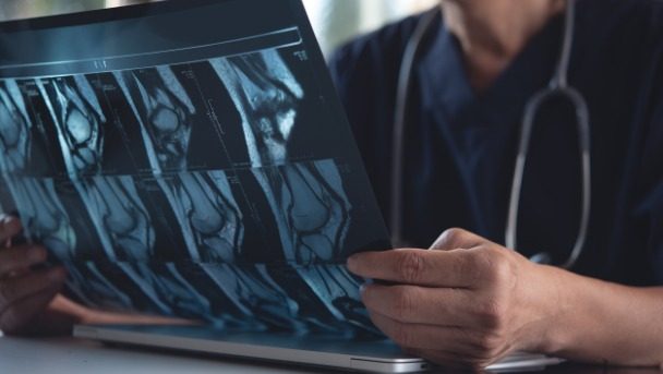 Building a customizable system for managing injection protocols HTEC Group